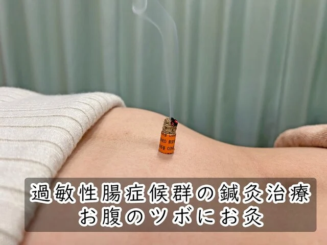 過敏性腸症候群の治療