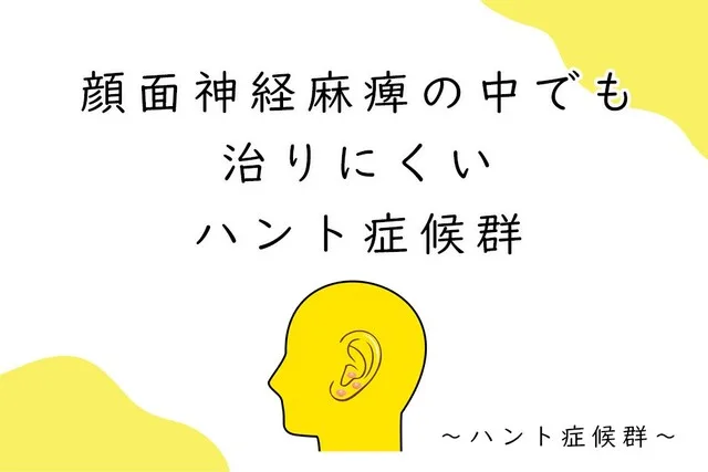 顔面神経麻痺の中でも治りにくいハント症候群